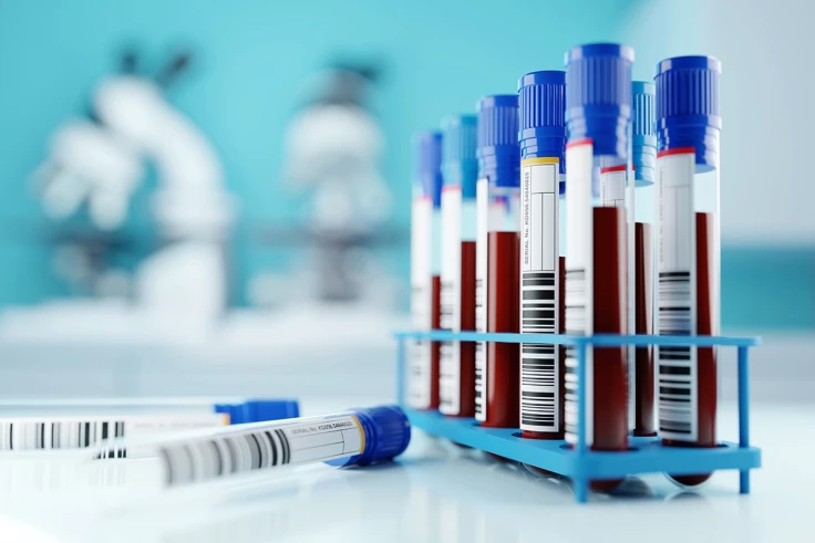 Image representing GET YOUR TEST RESULTS